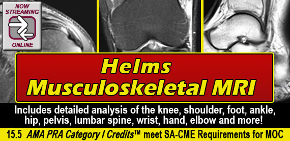Helms Musculoskeletal MRI