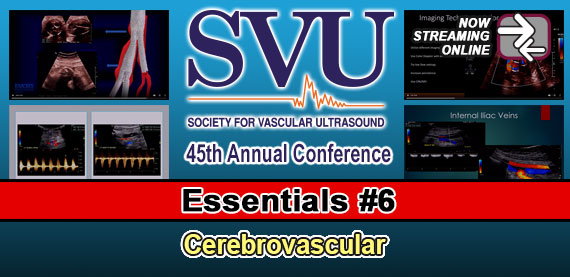 SVU Essentials #6: Cerebrovascular