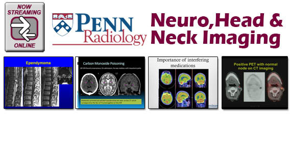 Penn Radiology's Neuro, Head and Neck Imaging