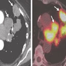 Oncologic Imaging CME