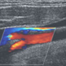 Vascular Ultrasound CME