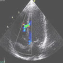 Echocardiography CME