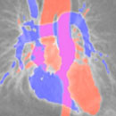 Cardiovascular Imaging