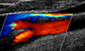 Vascular Ultrasound & Echo Combo