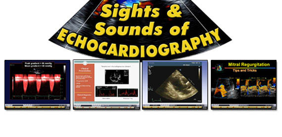 6th Annual Sights and Sounds of Echocardiography